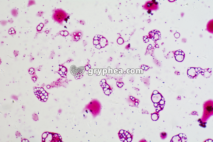 Salmonella typhi x200 - gryphea.com